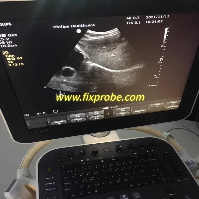 Philips L12-4 Linear Array Ultrasound Probe Repair and Sale