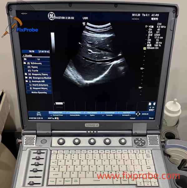 GE Logiq E Portable Ultrasound Machine Repair