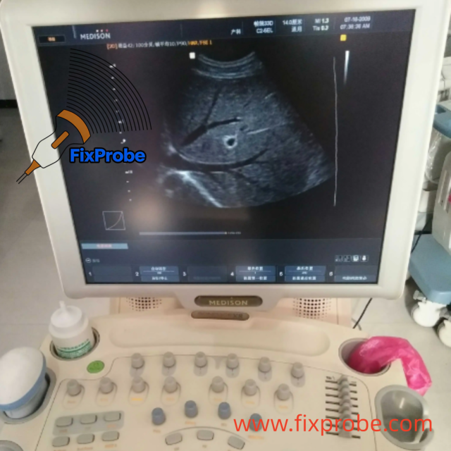 Samsung Medison SonoAce X8 Repairs