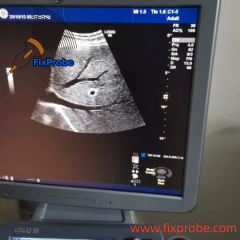 GE LOGIQ S8 Ultrasound Machine Repair and Sale