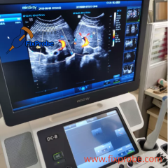 Mindray DC-8 Ultrasound Machine Repair Service