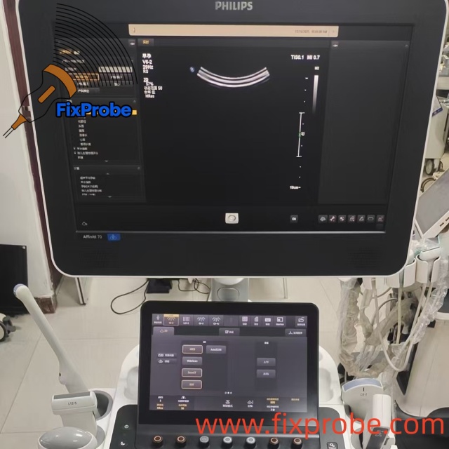 Philips Affiniti 70 Ultrasound Machine Repair and Sale Affiniti70