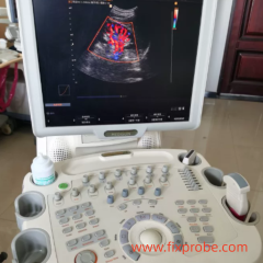 Medison SonoAce X8 Ultrasound Machine Repairs