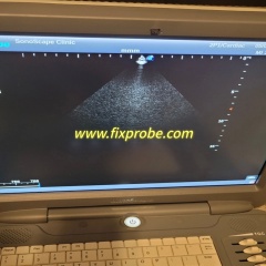 Sonoscape 2P1 Ultrasound Probe Repair and Sale