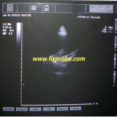 Toshiba PST-30BT Ultrasound Probe Repair and Sale
