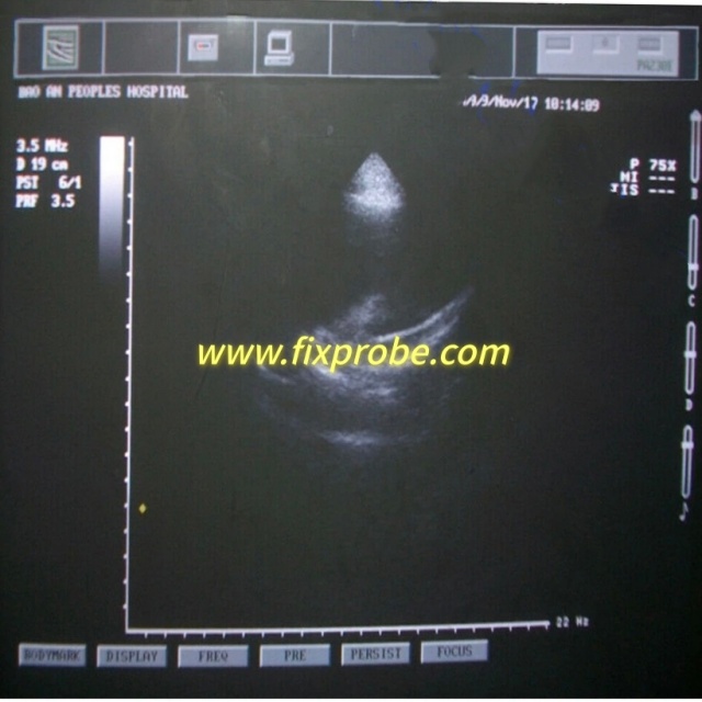 Toshiba PST-30BT Ultrasound Probe Repair and Sale