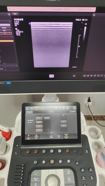 Pre-owned Philips Affiniti 70 for sale