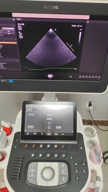 Pre-owned Philips Affiniti 70 for sale