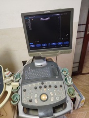 Siemens X150 Ultrasound machine for sale