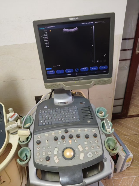 Siemens X150 Ultrasound machine for sale