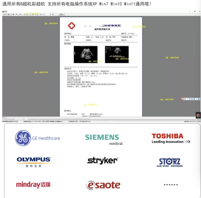 Ultrasound Report Software
