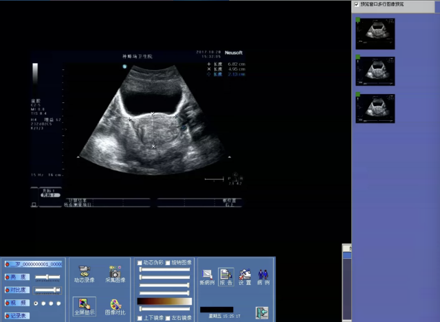 Ultrasound Report Software