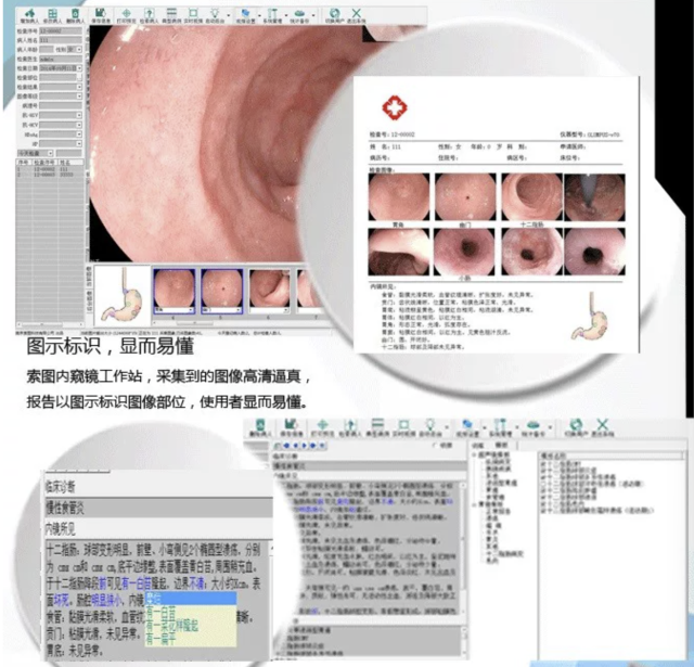 Ultrasound Report Software