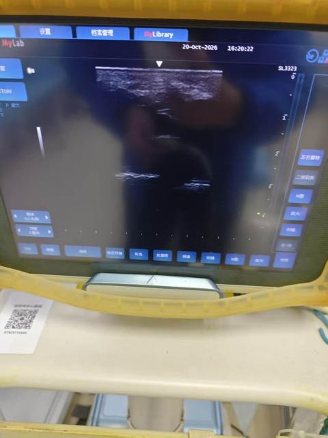 Linear probe strain-relief damaged Esaote SL3323 cable replacement