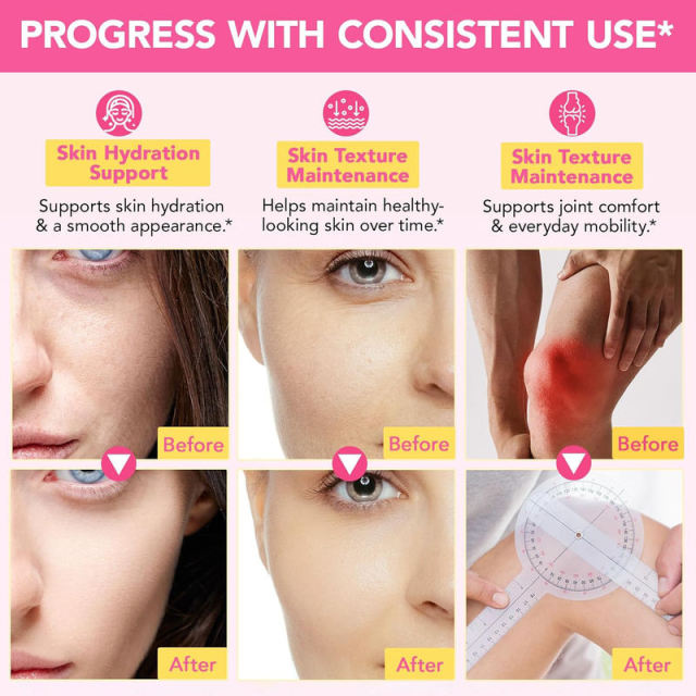 OEM Private Label Multi Collagen Peptides Powder,MY SHOP,OEM Private Label Multi Collagen Peptides Powder