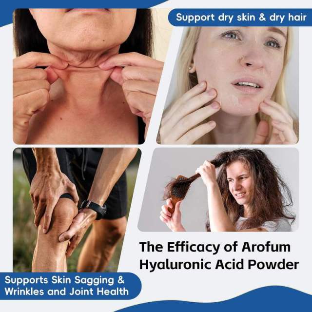 OEM Factory Hyaluronic Acid Powder With Collagen Peptides 100mg Hyaluronic Acid Per Serving 20mg Collagen Peptides 2X Hydration Formula Supports Dry Skin Dry Hair Skin Sagging Wrinkles Joint Health Gluten Free Dairy Free Soy Free 100g 833 Servings,MY SHOP,OEM Factory Hyaluronic Acid Powder With Collagen Peptides 100mg Hyaluronic Acid Per Serving 20mg Collagen Peptides 2X Hydration Formula Supports Dry Skin Dry Hair Skin Sagging Wrinkles Joint Health Gluten Free Dairy Free Soy Free 100g 833 Servings