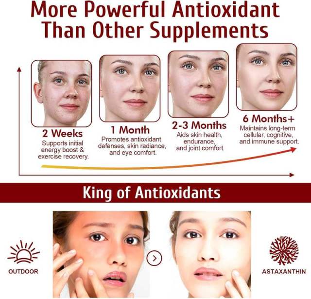 OEM Triple Strength Astaxanthin Softgels,MY SHOP,12mg Astaxanthin Softgels - Wholesale Probiotic Manufacturers