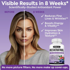 OEM Factory Extra Strength Resveratrol Blend 180 Capsules With Grape Seed Extract Green Tea Blackberry Blueberry Pomegranate Alfalfa 9 Powerful Herbs Supports Cardiovascular Health Anti-Aging Antioxidant Properties Skin Health Brain Support,MY SHOP,OEM Factory Extra Strength Resveratrol Blend 180 Capsules With Grape Seed Extract Green Tea Blackberry Blueberry Pomegranate Alfalfa 9 Powerful Herbs Supports Cardiovascular Health Anti-Aging Antioxidant Properties Skin Health Brain Support