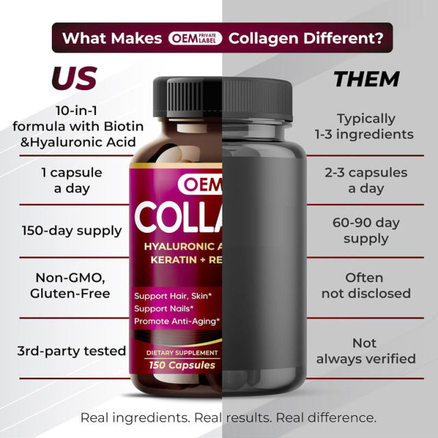 OEM Factory Collagen Complex Capsules With Hyaluronic Acid Biotin Keratin Resveratrol Multi-Source Collagen Fish Bovine Chicken Eggshell Supports Hair Skin Nails Anti-Aging 150 Capsules 150 Day Supply,MY SHOP,OEM Factory Collagen Complex Capsules With Hyaluronic Acid Biotin Keratin Resveratrol Multi-Source Collagen Fish Bovine Chicken Eggshell Supports Hair Skin Nails Anti-Aging 150 Capsules 150 Day Supply