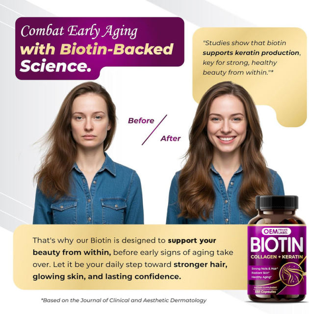 OEM Supplier Advanced 16-in-1 Beauty Formula Hydrolyzed Fish Collagen Chicken Bone Broth Bovine Hide Eggshell Membrane Collagen Biotin Keratin Hyaluronic Acid Vitamin D3 C Thiamin Riboflavin Niacin B6 Folate Trans-Resveratrol 150 Capsules,MY SHOP,OEM Supplier Advanced 16-in-1 Beauty Formula Hydrolyzed Fish Collagen Chicken Bone Broth Bovine Hide Eggshell Membrane Collagen Biotin Keratin Hyaluronic Acid Vitamin D3 C Thiamin Riboflavin Niacin B6 Folate Trans-Resveratrol 150 Capsules