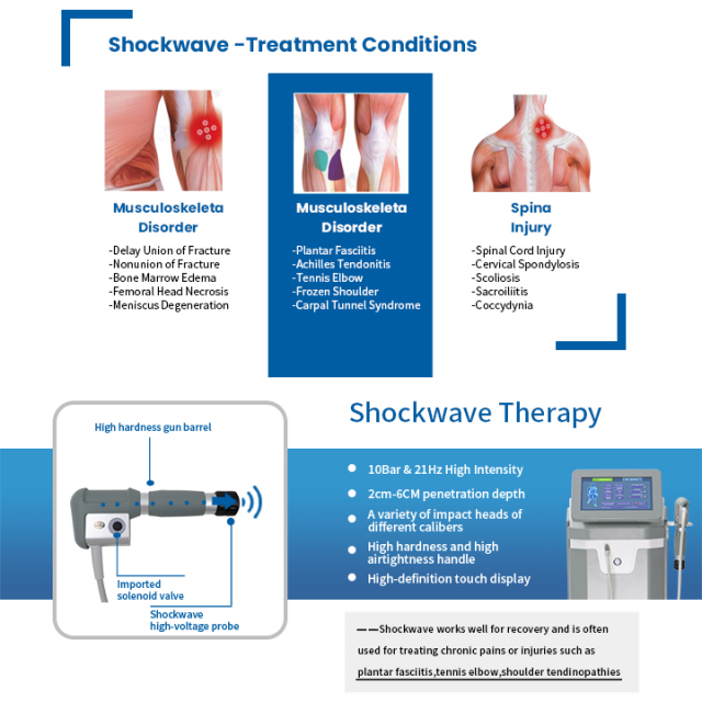 TA06+2  Single Shockwave + Single Ultrasound