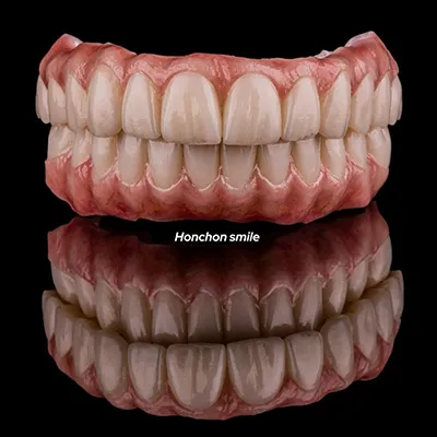 HT Plus zirconia for long-span bridges