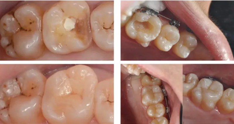 Non-Sintered Ceramic Block