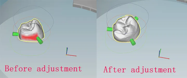 Minimize undercuts