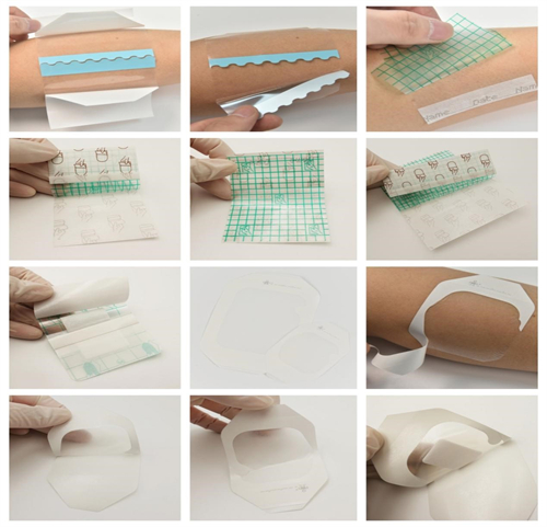 Gemmy Medical Transparent Dressing: Protective, Breathable Wound Care Solution