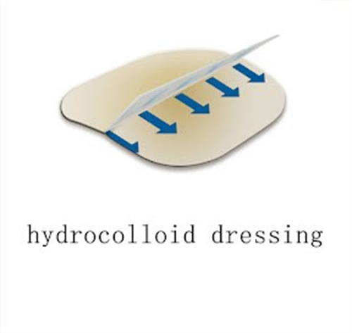 Gemmy Medical Hydrocolloid Dressing: Structure, Principles, Advantages, Usage & Precautions
