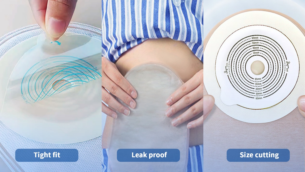 Gemmy Medical Colostomy vs Ileostomy Bags: Key Differences & Guide