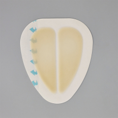 Sacral hydrocolloid dressing, size 15 cm x 18 cm, aesidhve bordered hydrocolloid bandage