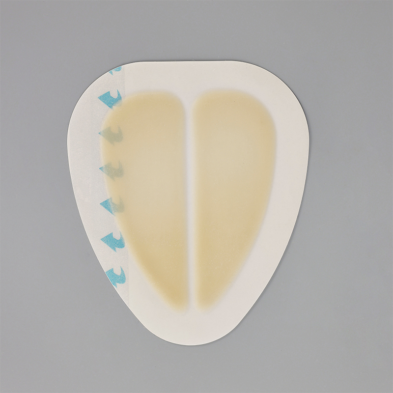Sacral hydrocolloid dressing, size 15 cm x 18 cm, aesidhve bordered hydrocolloid bandage