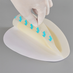 Sacral hydrocolloid dressing, size 15 cm x 18 cm, aesidhve bordered hydrocolloid bandage