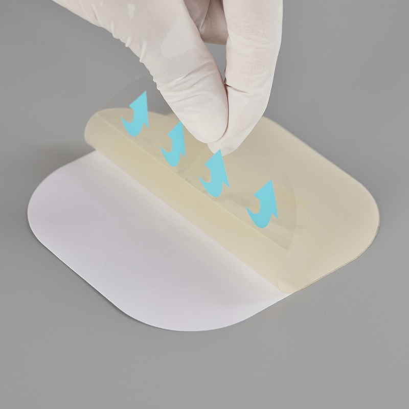 Ultra-thin Hydrocolloid dressing, size 10 cm x 10 cm / 4"x 4", Thickness 0.3mm, 0.4mm, 0.5mm, 0.6mm customizable solutions
