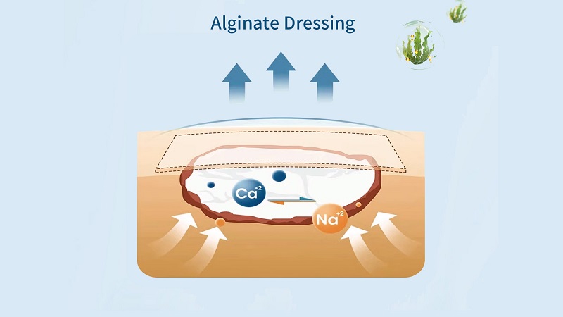 Gemmy Medical Alginate Dressings: Solution for Exudating Wounds