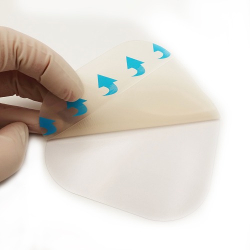Ultra-thin Hydrocolloid dressing, size 5 cm x 5 cm / 2"x 2", Thickness 0.3mm, 0.4mm, 0.6mm customizable solutions