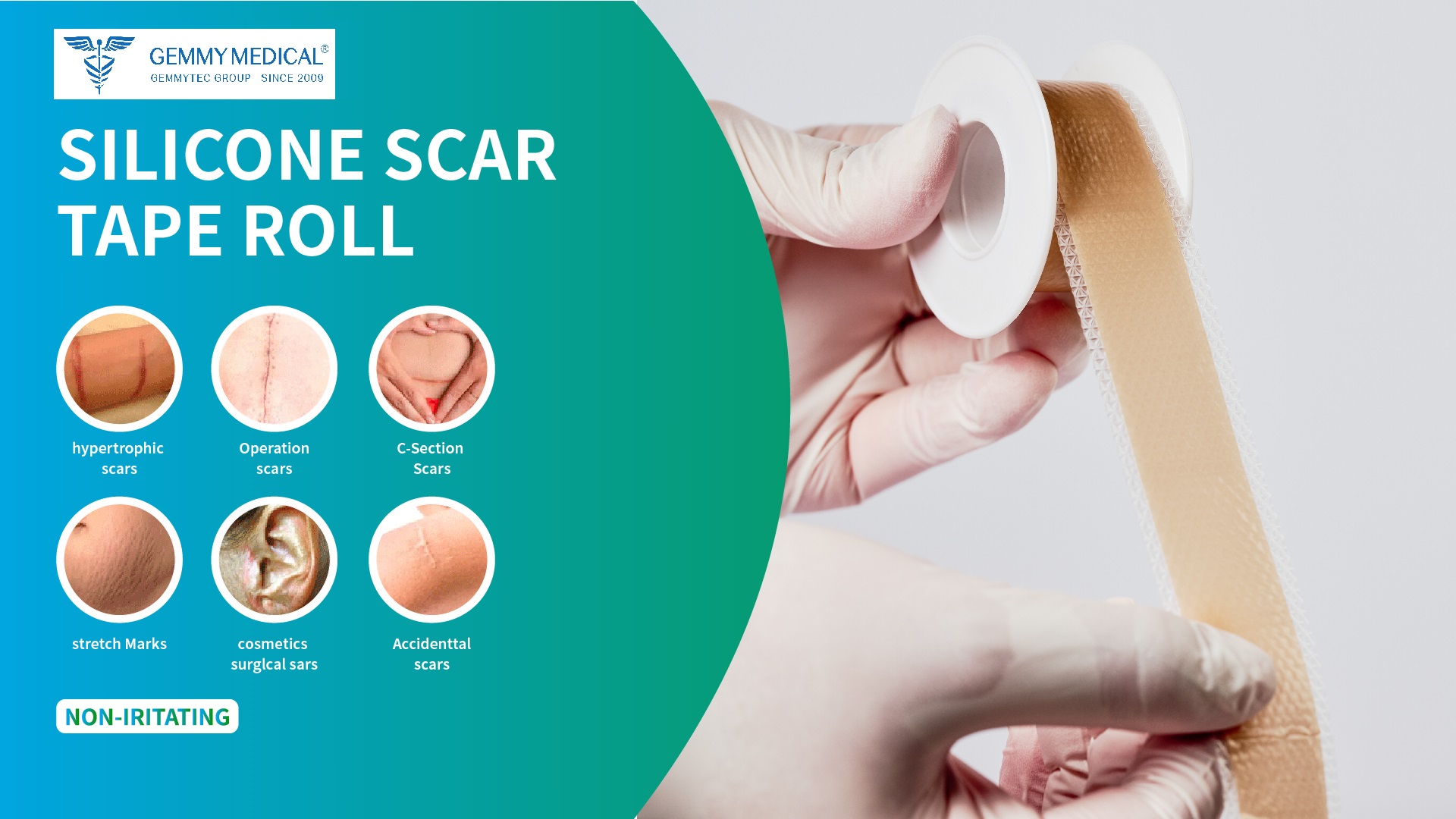 Optimizing Inventory: Smart Choices in Silicone-Based Medical Dressing