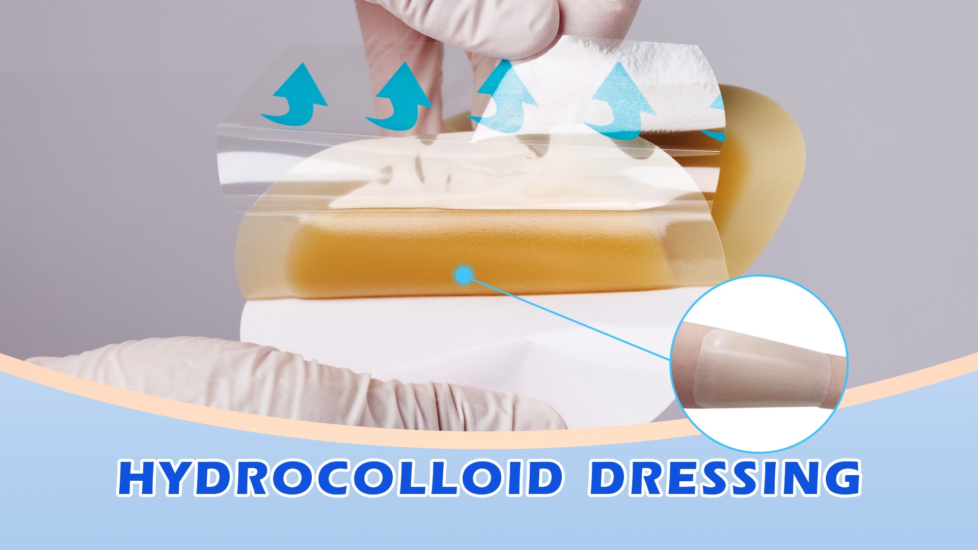 Efficiency in Wound Care: The Strategic Role of Hydrocolloid Dressings