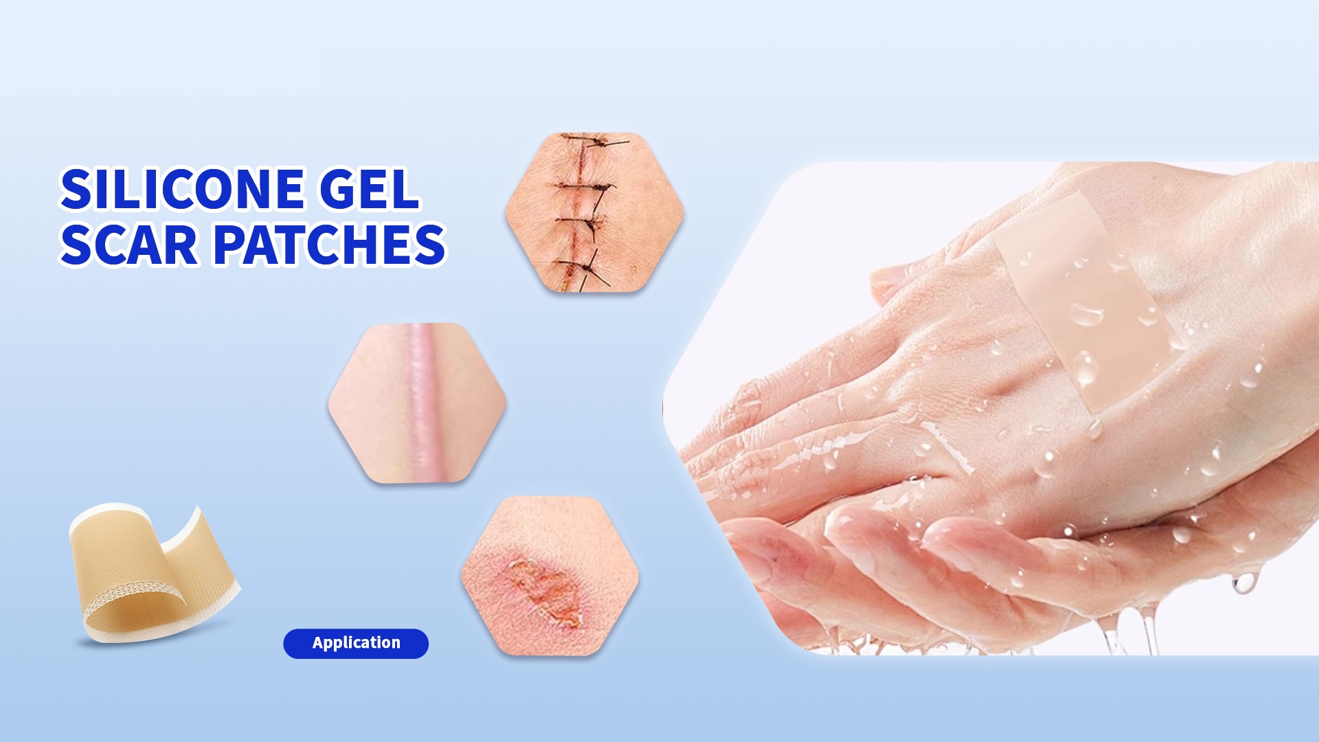 Gemmy Medical Silicone Gel Scar Patches: Rewrite Your Scar Story