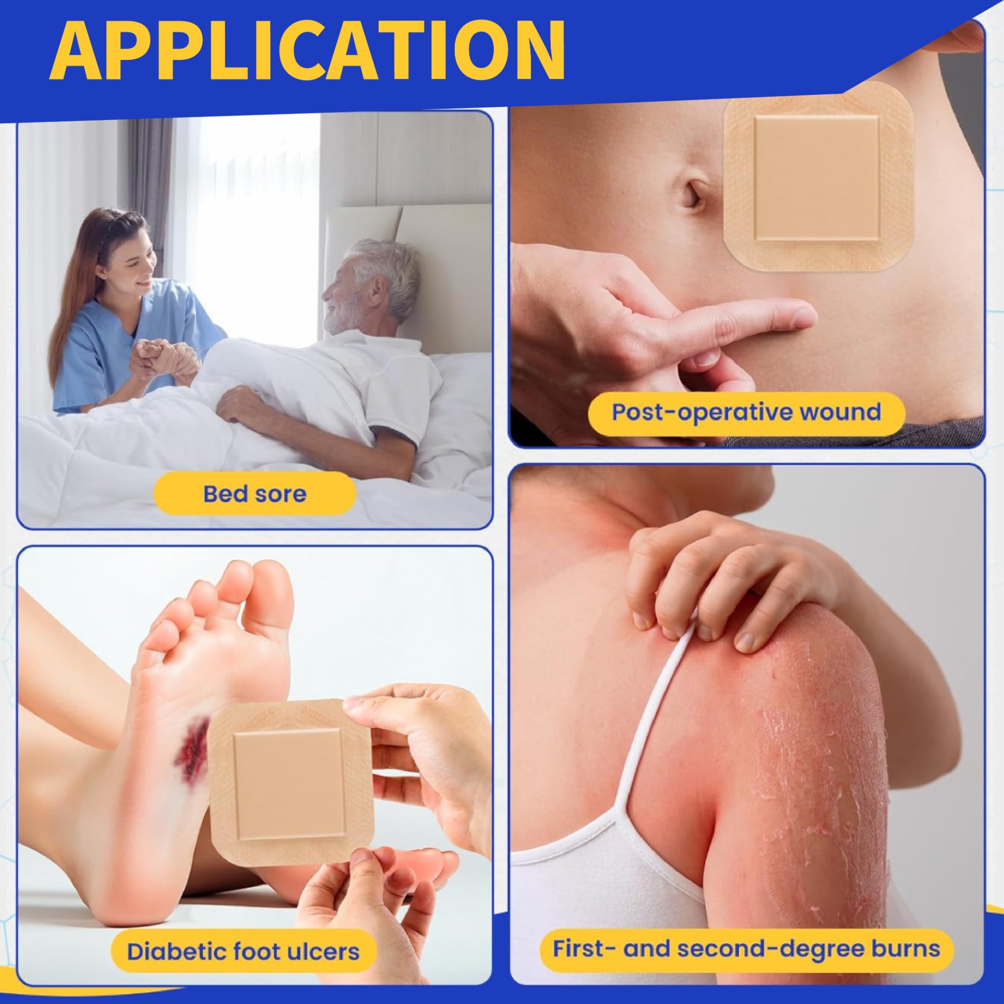 Silicone Adhesive Foam Dressing With Border, Size 10 cm x 10 cm / 4'' x 4'', Advanced Wound Care Solution