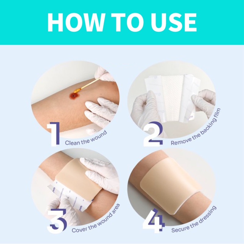 Silicone Adhesive Foam Dressing 18 cm x 18 cm Silicone Foam Dressing