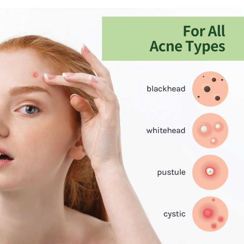 Hydrocolloid Acne Patch round shape 36 pieces