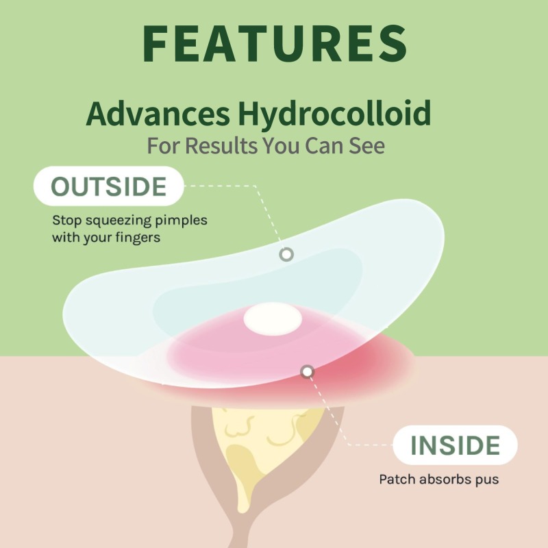 Hydrocolloid Acne Patch round shape 36 pieces