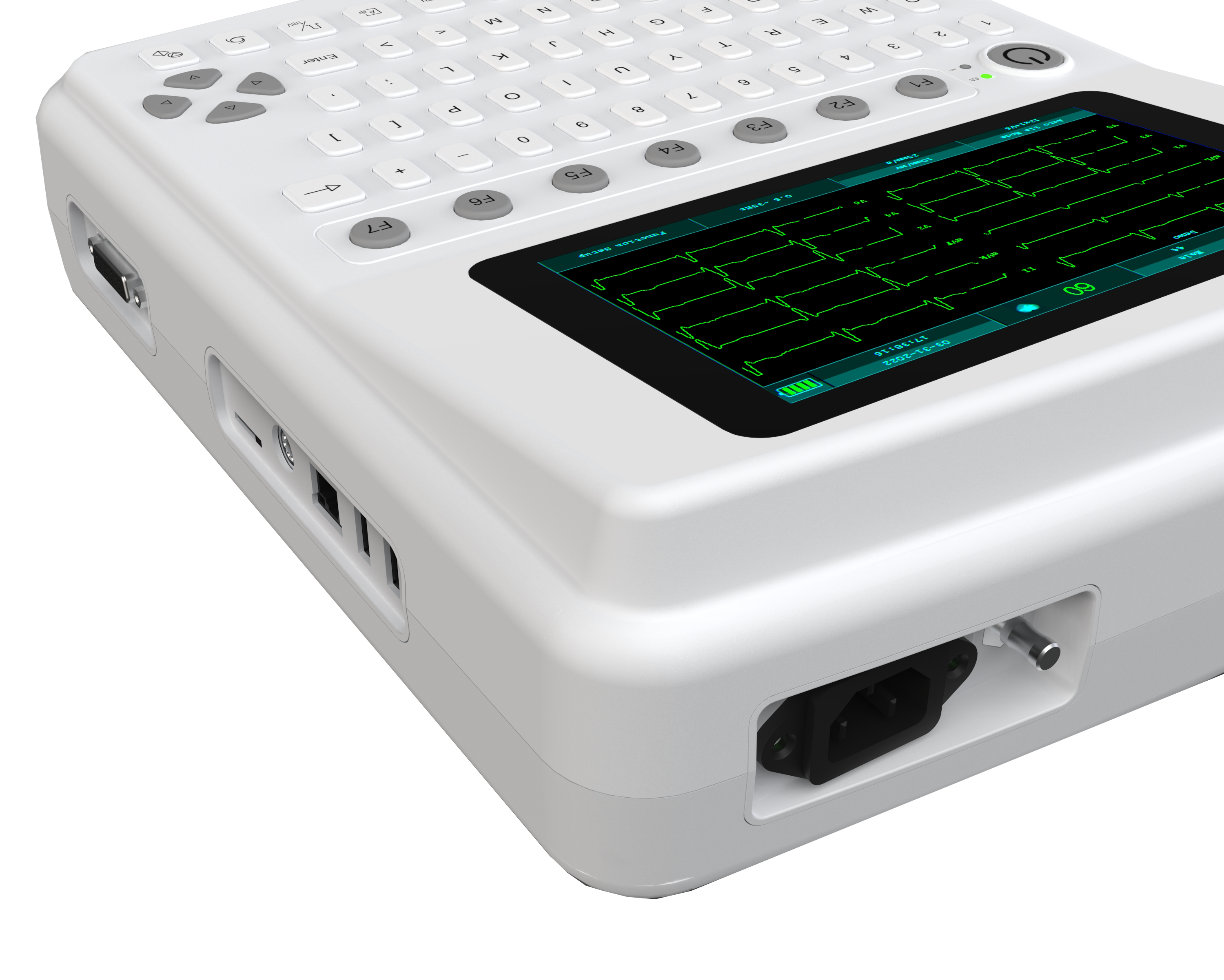 Efficient ECG Diagnosis with Enterprise-Grade Data Management – The ECG1201 12-Lead Electrocardiograph with 1000-Case Internal Storage