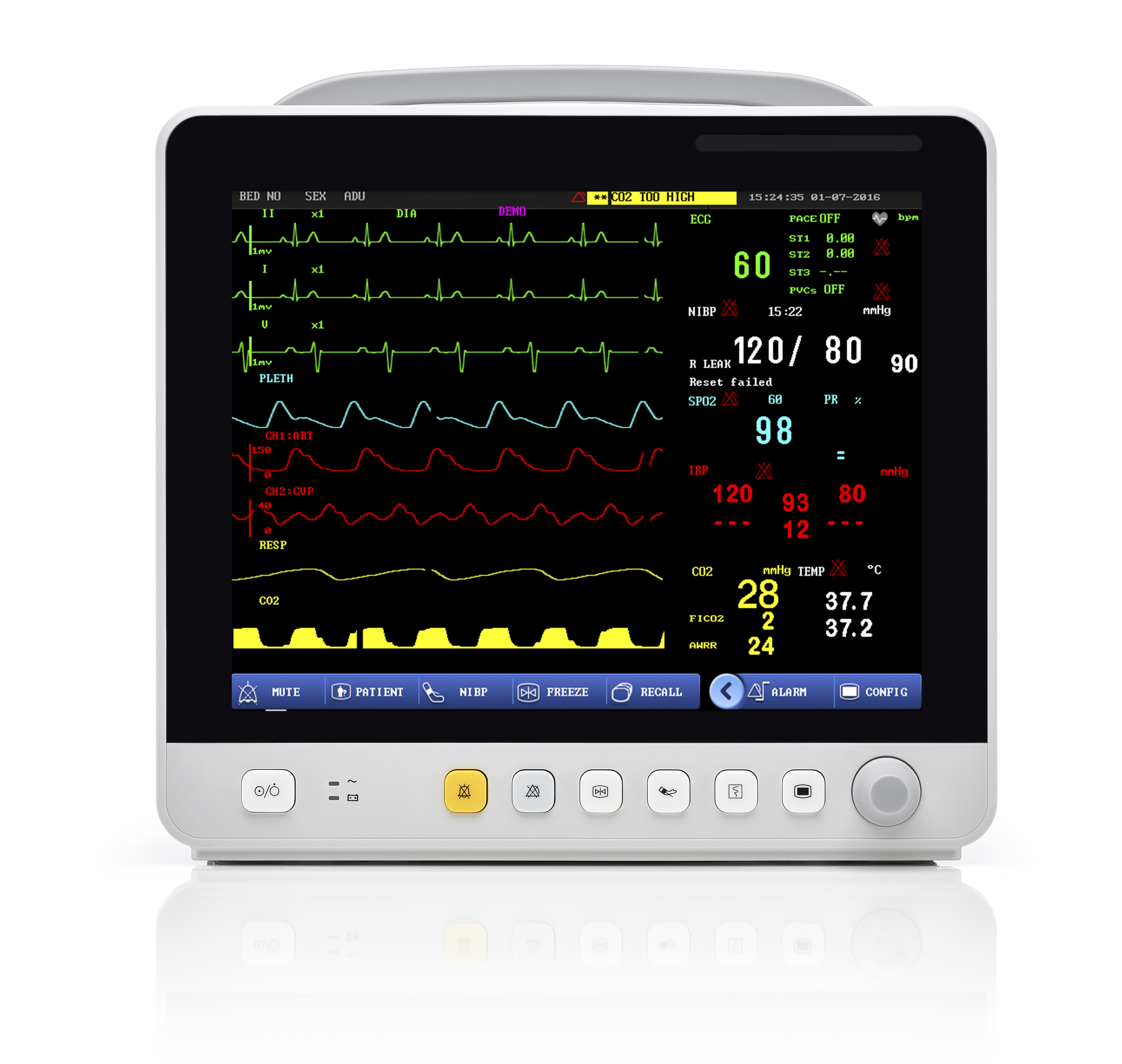Comprehensive Monitoring for Critical Care – The E12 8-Parameter Patient Monitor with IBP, ETCO2, and ST Analysis