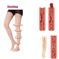 Medical-Grade Compression Stockings – 15–20mmHg Open-Toe Support