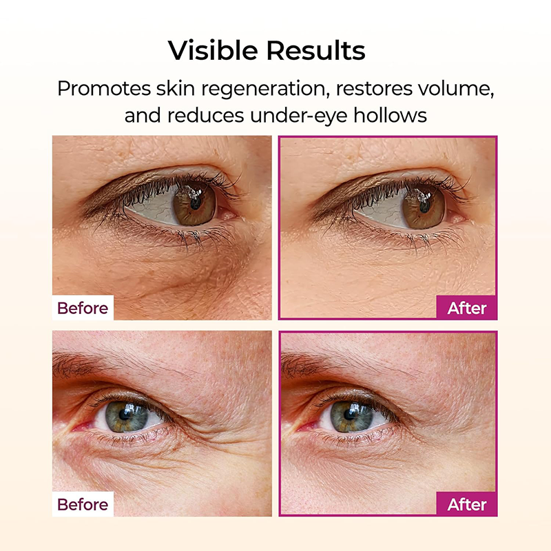 OEM Anti Aging Skincare Calcium Multi Balm Stick Collagen Wrinkles Stick for Firming & Reducing Wrinkles for Eye Neck & Face