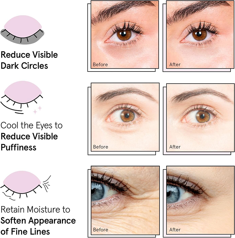 Private Label Vegan Under Eye Patches for Dark Circles Naturals Hyaluronic Acid Eye Gels Mask-Reduce Wrinkles Puffy & Bags
