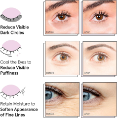Private Label Vegan Under Eye Patches for Dark Circles Naturals Hyaluronic Acid Eye Gels Mask-Reduce Wrinkles Puffy & Bags